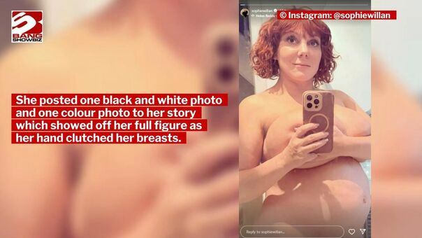 Sophie Willan Nude Leaks OnlyFans Photo 9